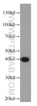 FA2H Antibody in Western Blot (WB)