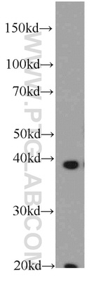 FA2H Antibody in Western Blot (WB)