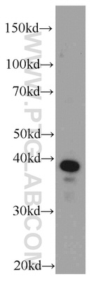 FA2H Antibody in Western Blot (WB)