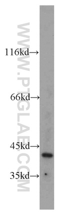 FA2H Antibody in Western Blot (WB)