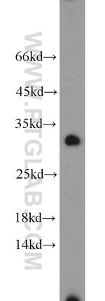 NOL12 Antibody in Western Blot (WB)