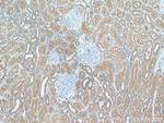 HOOK3 Antibody in Immunohistochemistry (Paraffin) (IHC (P))