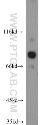 HOOK3 Antibody in Western Blot (WB)