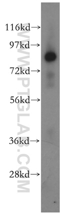 HOOK3 Antibody in Western Blot (WB)