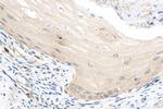 WIT1 Antibody in Immunohistochemistry (Paraffin) (IHC (P))