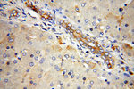 DLC1 Antibody in Immunohistochemistry (Paraffin) (IHC (P))