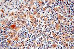 DLC1 Antibody in Immunohistochemistry (Paraffin) (IHC (P))