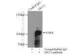 DLC1 Antibody in Immunoprecipitation (IP)