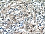 RPP25 Antibody in Immunohistochemistry (Paraffin) (IHC (P))