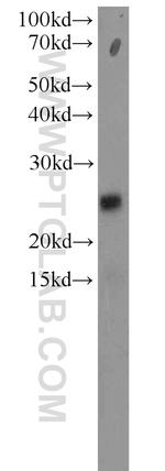 RPP25 Antibody in Western Blot (WB)