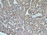 MDH2 Antibody in Immunohistochemistry (Paraffin) (IHC (P))