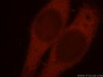 MAPKAP1 Antibody in Immunocytochemistry (ICC/IF)