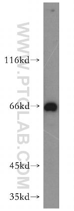 MAPKAP1 Antibody in Western Blot (WB)