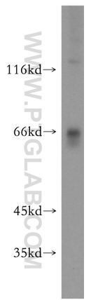 MAPKAP1 Antibody in Western Blot (WB)