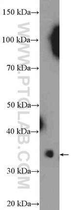 TRADD Antibody in Western Blot (WB)