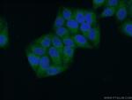 CYB5B Antibody in Immunocytochemistry (ICC/IF)