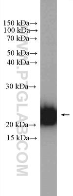 CYB5B Antibody in Western Blot (WB)