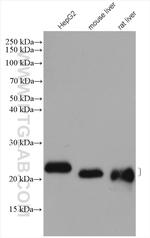 CYB5B Antibody in Western Blot (WB)