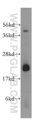 CYB5B Antibody in Western Blot (WB)