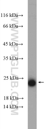 CYB5B Antibody in Western Blot (WB)