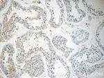 ALKBH7 Antibody in Immunohistochemistry (Paraffin) (IHC (P))