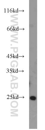 ALKBH7 Antibody in Western Blot (WB)