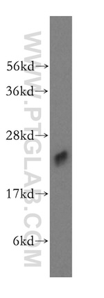 ALKBH7 Antibody in Western Blot (WB)