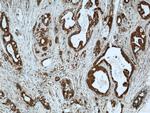 LIMD2 Antibody in Immunohistochemistry (Paraffin) (IHC (P))