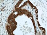 LIMD2 Antibody in Immunohistochemistry (Paraffin) (IHC (P))