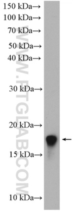 LIMD2 Antibody in Western Blot (WB)
