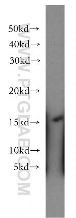 LIMD2 Antibody in Western Blot (WB)