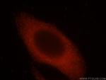 VPS24 Antibody in Immunocytochemistry (ICC/IF)