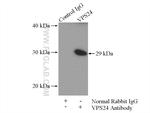 VPS24 Antibody in Immunoprecipitation (IP)