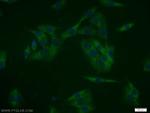 MAGEA11 Antibody in Immunocytochemistry (ICC/IF)