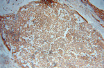 UBE2D4 Antibody in Immunohistochemistry (Paraffin) (IHC (P))