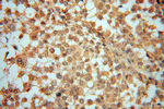 UBE2D4 Antibody in Immunohistochemistry (Paraffin) (IHC (P))