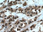 UBE2D4 Antibody in Immunohistochemistry (Paraffin) (IHC (P))