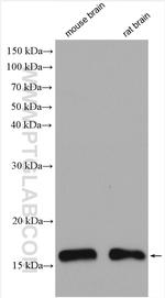 UBE2D4 Antibody in Western Blot (WB)