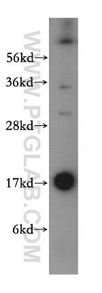 UBE2D4 Antibody in Western Blot (WB)