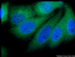 VPS28 Antibody in Immunocytochemistry (ICC/IF)