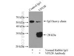 VPS28 Antibody in Immunoprecipitation (IP)