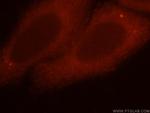 UNC45A Antibody in Immunocytochemistry (ICC/IF)