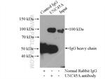 UNC45A Antibody in Immunoprecipitation (IP)