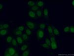 ADAT1 Antibody in Immunocytochemistry (ICC/IF)