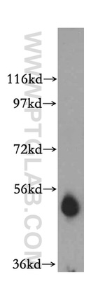 ADAT1 Antibody in Western Blot (WB)