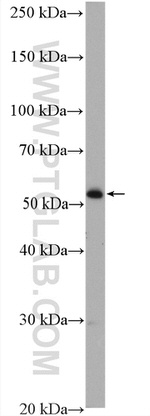 ADAT1 Antibody in Western Blot (WB)