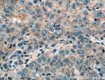 RAB31 Antibody in Immunohistochemistry (Paraffin) (IHC (P))