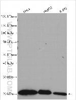 RAB31 Antibody in Western Blot (WB)