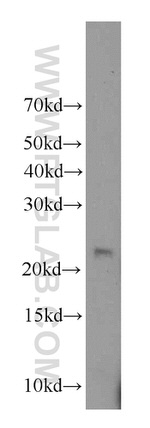 RAB31 Antibody in Western Blot (WB)