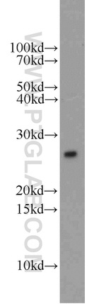 UBE2E3 Antibody in Western Blot (WB)